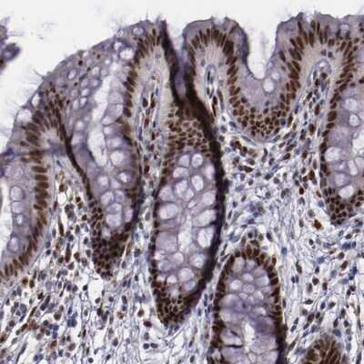Immunohistochemistry-Paraffin: Chk2 Antibody [NBP1-90024]