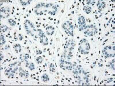 Immunohistochemistry: Chk2 Antibody (OTI5C4) - Azide and BSA Free [NBP2-71688]