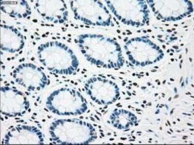 Immunohistochemistry: Chk2 Antibody (OTI5C4) - Azide and BSA Free [NBP2-71688]