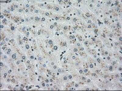 Immunohistochemistry: Chk2 Antibody (OTI5C4) - Azide and BSA Free [NBP2-71688]