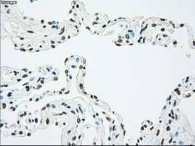 Immunohistochemistry: Chk2 Antibody (OTI5C4) - Azide and BSA Free [NBP2-71688]