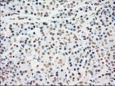 Immunohistochemistry: Chk2 Antibody (OTI5C4) - Azide and BSA Free [NBP2-71688]