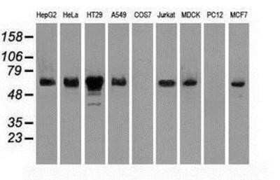 Western Blot: Chk2 Antibody (OTI5C4)Azide and BSA Free [NBP2-71688]