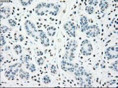 Immunohistochemistry-Paraffin: Chk2 Antibody (OTI5C4) [NBP1-47695]