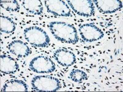 Immunohistochemistry-Paraffin: Chk2 Antibody (OTI5C4) [NBP1-47695]