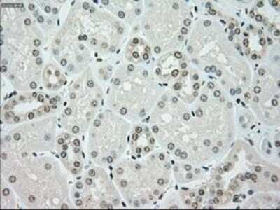Immunohistochemistry-Paraffin: Chk2 Antibody (OTI5C4) [NBP1-47695]