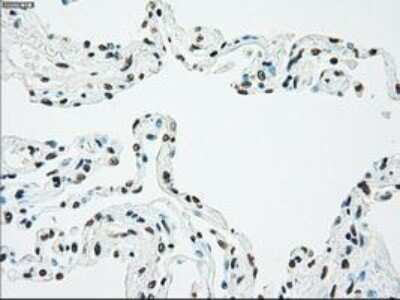 Immunohistochemistry-Paraffin: Chk2 Antibody (OTI5C4) [NBP1-47695]