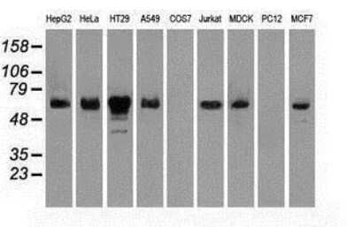 Western Blot: Chk2 Antibody (OTI5C4) [NBP1-47695]