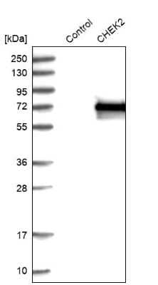 Western Blot: Chk2 Antibody [NBP1-90024]