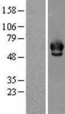 Western Blot: Chk2 Overexpression Lysate [NBL1-09147]