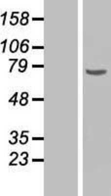 Western Blot: Chk2 Overexpression Lysate [NBP2-10753]