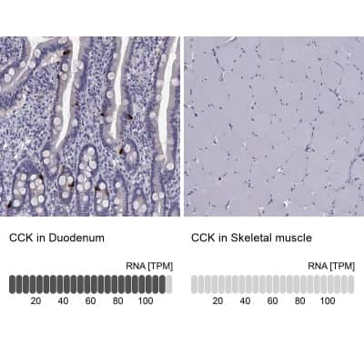 Immunohistochemistry-Paraffin: Cholecystokinin Antibody [NBP2-62664]