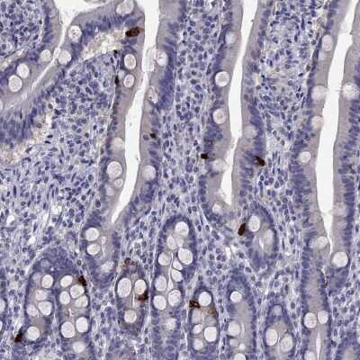 Immunohistochemistry-Paraffin: Cholecystokinin Antibody [NBP2-62664]