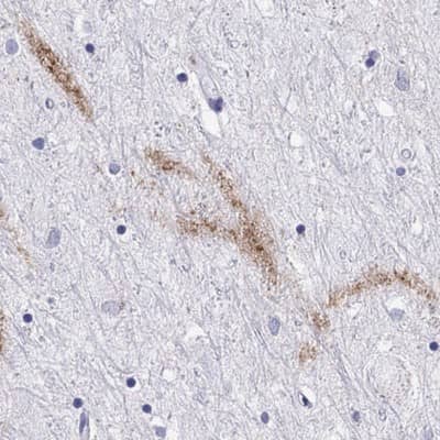 Immunohistochemistry-Paraffin: Cholecystokinin Antibody [NBP2-62664]