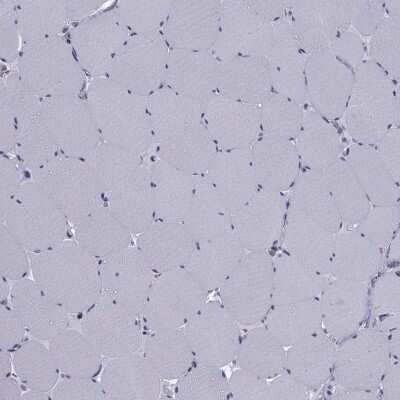 Immunohistochemistry-Paraffin: Cholecystokinin Antibody [NBP2-62664]