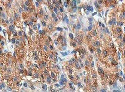 Immunohistochemistry-Paraffin: Cholecystokinin Antibody [NBP3-18225]