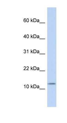 Western Blot: Cholecystokinin Antibody [NBP1-59329]