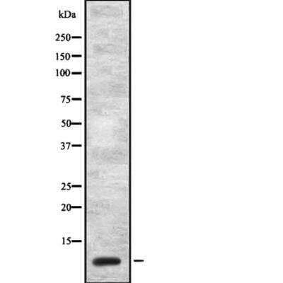 Western Blot: Cholecystokinin Antibody [NBP3-18225]