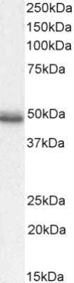 Western Blot: Cholecystokinin-B R/CCKBR Antibody [NB100-2803]