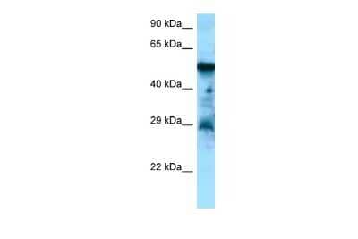 Western Blot: Cholecystokinin-B R/CCKBR Antibody [NBP2-88784]