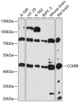 Western Blot: Cholecystokinin-B R/CCKBR AntibodyAzide and BSA Free [NBP2-92171]