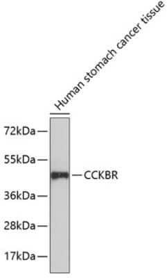 Western Blot: Cholecystokinin-B R/CCKBR AntibodyAzide and BSA Free [NBP3-03043]