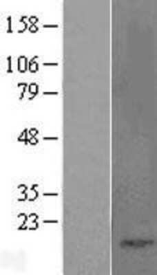 Western Blot: Cholecystokinin Overexpression Lysate [NBL1-08838]