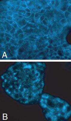 Immunocytochemistry/ Immunofluorescence: Cholesterol Cell-Based Detection Assay Kit (Fluorometric) [KA1304]