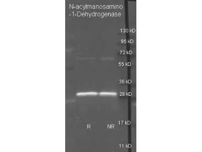 Western Blot: Cholesterol Oxidase Antibody [NB600-625]