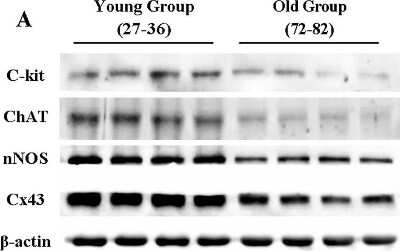 Western Blot: Choline Acetyltransferase/ChAT Antibody [NBP1-30052]