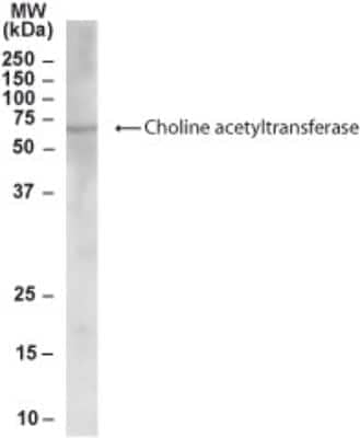 Western Blot: Choline Acetyltransferase/ChAT Antibody [NB300-910]