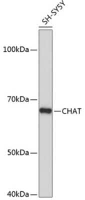 Western Blot: Choline Acetyltransferase/ChAT Antibody (1I4V0) [NBP3-15621]