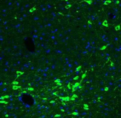 Immunohistochemistry: Choline Acetyltransferase/ChAT Antibody (CL3169) [NBP2-46650]