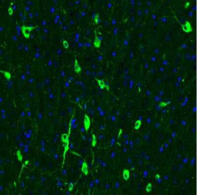 Immunohistochemistry: Choline Acetyltransferase/ChAT Antibody (CL3169) [NBP2-46650]