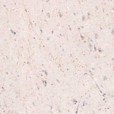 Immunohistochemistry-Paraffin: Choline Acetyltransferase/ChAT Antibody (CL3169) [NBP2-46650]