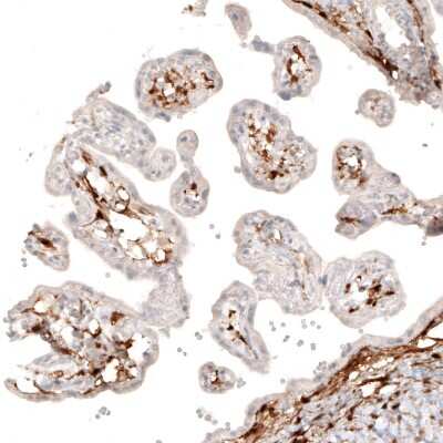 Immunohistochemistry-Paraffin: Choline Acetyltransferase/ChAT Antibody (CL3169) [NBP2-46650]