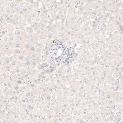 Immunohistochemistry-Paraffin: Choline Acetyltransferase/ChAT Antibody (CL3169) [NBP2-46650]