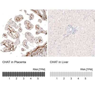 Immunohistochemistry-Paraffin: Choline Acetyltransferase/ChAT Antibody (CL3169) [NBP2-46650]