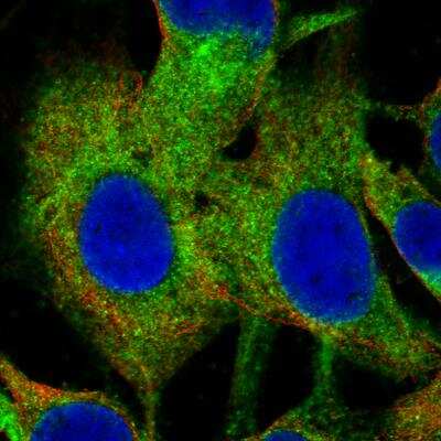 Immunocytochemistry/ Immunofluorescence: Choline Acetyltransferase/ChAT Antibody (CL3173) [NBP2-46620]
