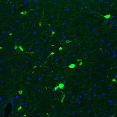 Immunohistochemistry: Choline Acetyltransferase/ChAT Antibody (CL3173) [NBP2-46620]