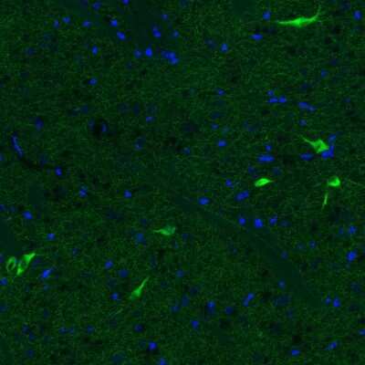 Immunohistochemistry: Choline Acetyltransferase/ChAT Antibody (CL3173) [NBP2-46620]