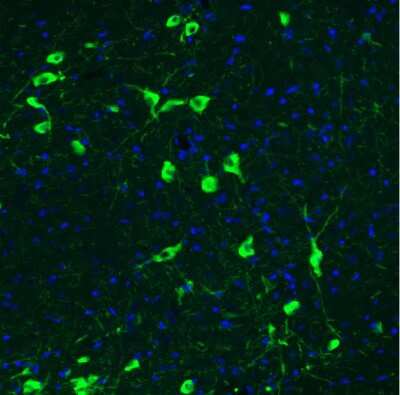 Immunohistochemistry: Choline Acetyltransferase/ChAT Antibody (CL3173) [NBP2-46620]