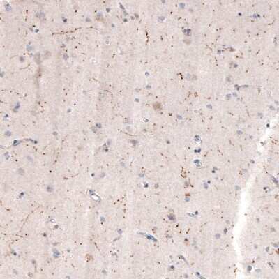 Immunohistochemistry-Paraffin: Choline Acetyltransferase/ChAT Antibody (CL3173) [NBP2-46620]