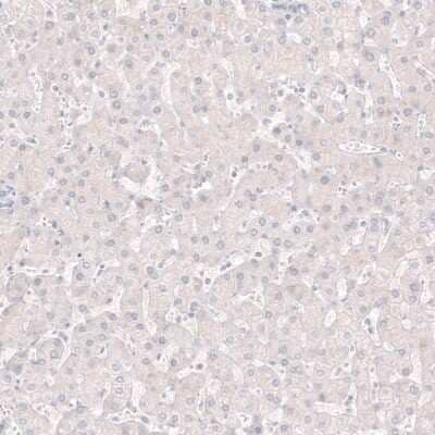 Immunohistochemistry-Paraffin: Choline Acetyltransferase/ChAT Antibody (CL3173) [NBP2-46620]