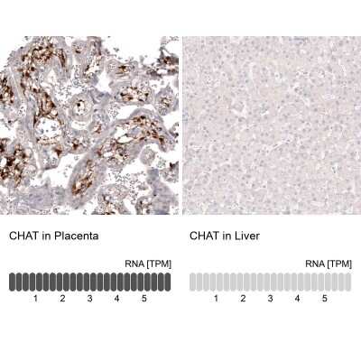 Immunohistochemistry-Paraffin: Choline Acetyltransferase/ChAT Antibody (CL3173) [NBP2-46620]