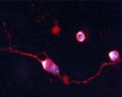 Immunocytochemistry/ Immunofluorescence: Choline Acetyltransferase/ChAT Antibody [NB110-89724]