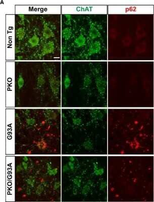 Immunocytochemistry/ Immunofluorescence: Choline Acetyltransferase/ChAT Antibody [NBP1-30052]