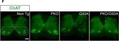 Immunocytochemistry/ Immunofluorescence: Choline Acetyltransferase/ChAT Antibody [NBP1-30052]