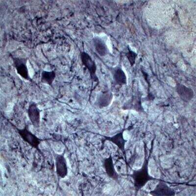 Immunohistochemistry Free-Floating: Choline Acetyltransferase/ChAT Antibody [NB110-89724]