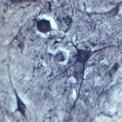 Immunohistochemistry Free-Floating: Choline Acetyltransferase/ChAT Antibody [NB110-89724]